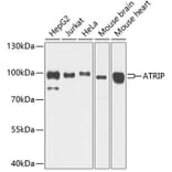 Western Blot - Anti-ATRIP Antibody (A12083) - Antibodies.com