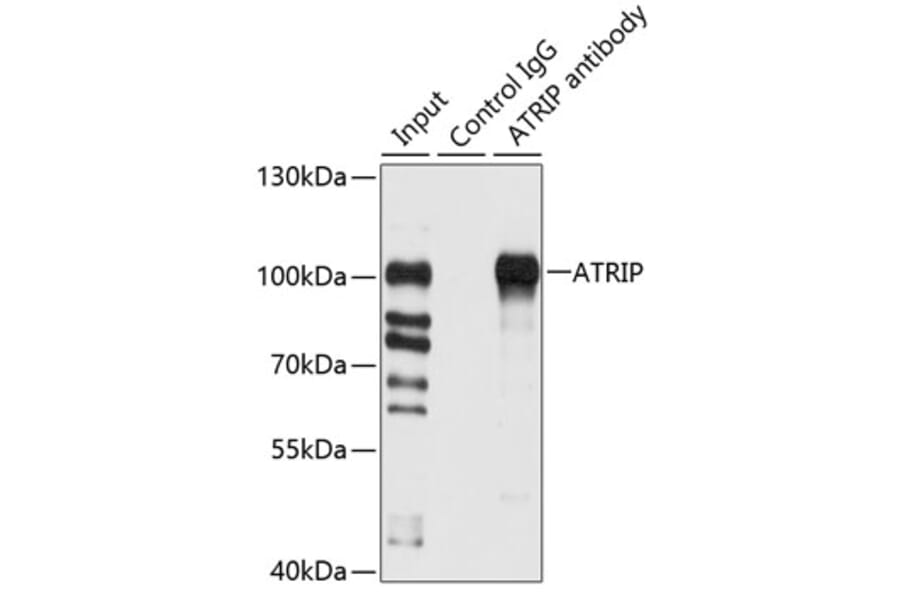 Western Blot - Anti-ATRIP Antibody (A12083) - Antibodies.com