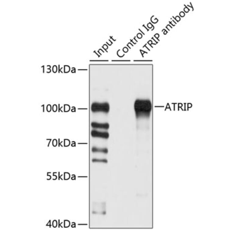 Western Blot - Anti-ATRIP Antibody (A12083) - Antibodies.com