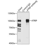 Western Blot - Anti-ATRIP Antibody (A12083) - Antibodies.com