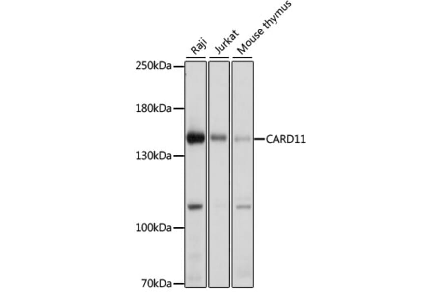 Western Blot - Anti-Carma 1/CARD11 Antibody (A12084) - Antibodies.com