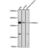 Western Blot - Anti-Carma 1/CARD11 Antibody (A12084) - Antibodies.com