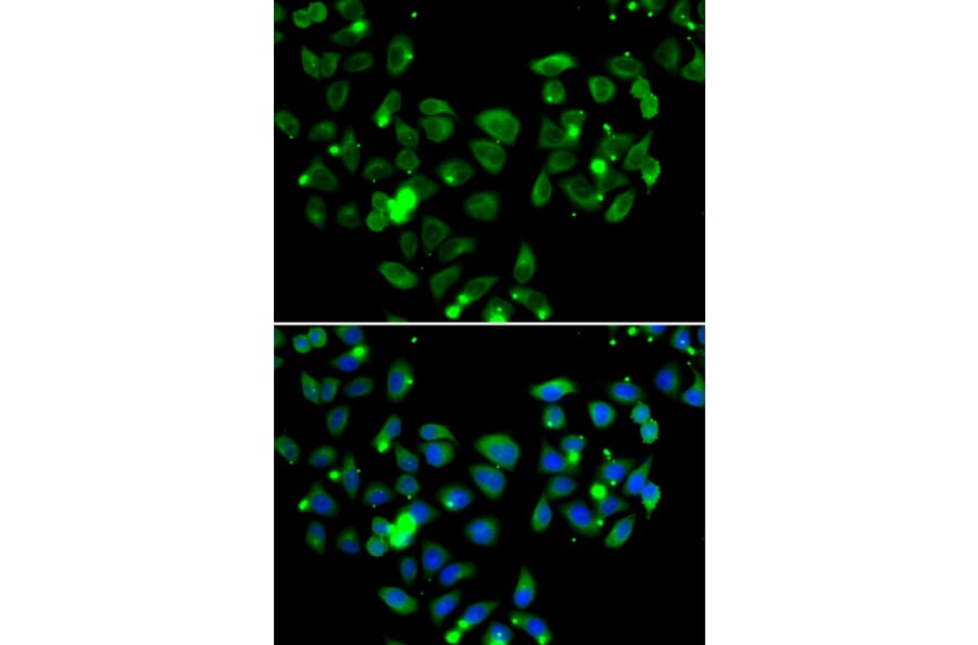 Immunofluorescence - Anti-Carma 1/CARD11 Antibody (A12084) - Antibodies.com