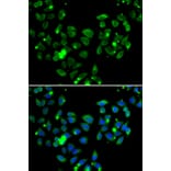 Immunofluorescence - Anti-Carma 1/CARD11 Antibody (A12084) - Antibodies.com