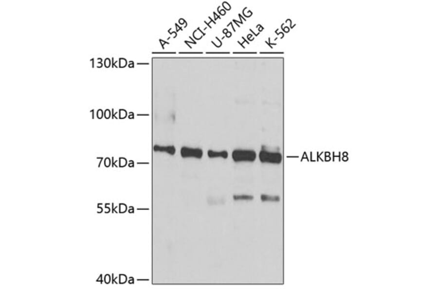 Western Blot - Anti-ALKBH8 Antibody (A12085) - Antibodies.com
