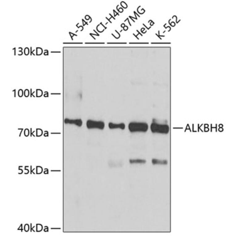 Western Blot - Anti-ALKBH8 Antibody (A12085) - Antibodies.com