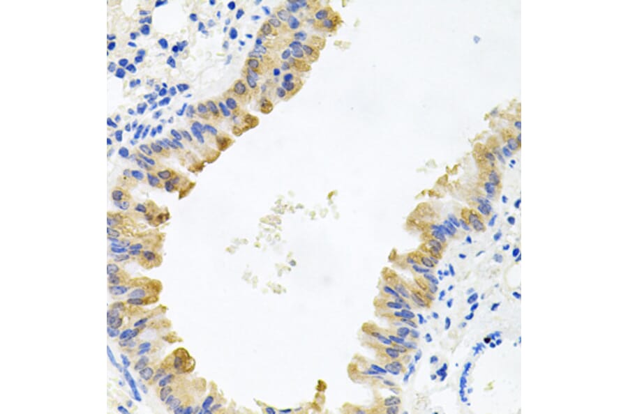 Immunohistochemistry - Anti-ALKBH8 Antibody (A12085) - Antibodies.com