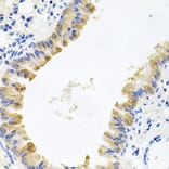 Immunohistochemistry - Anti-ALKBH8 Antibody (A12085) - Antibodies.com