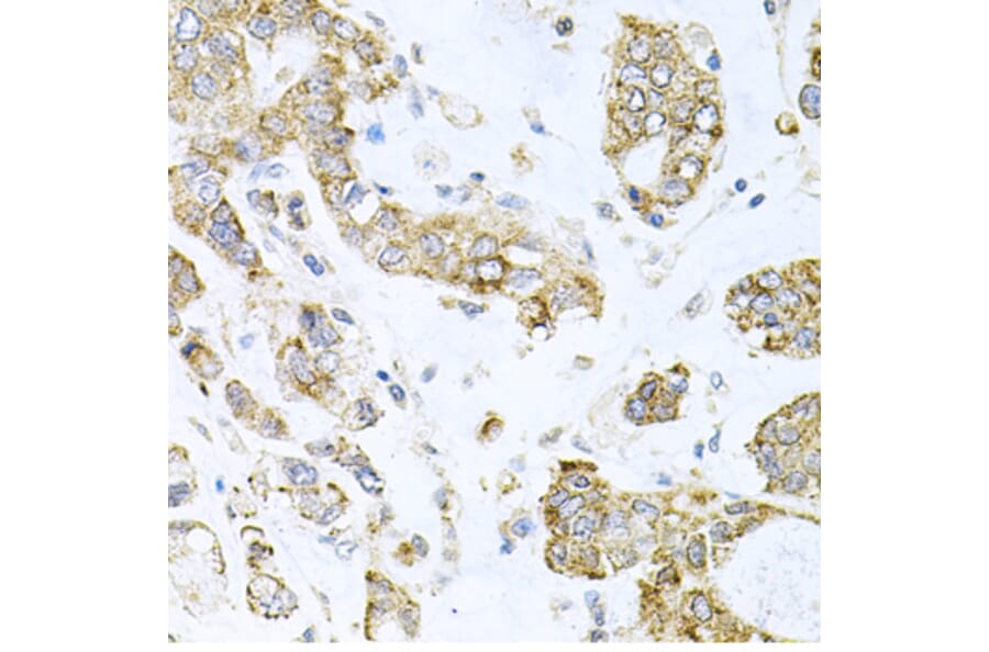 Immunohistochemistry - Anti-ALKBH8 Antibody (A12085) - Antibodies.com