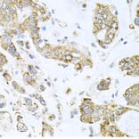 Immunohistochemistry - Anti-ALKBH8 Antibody (A12085) - Antibodies.com