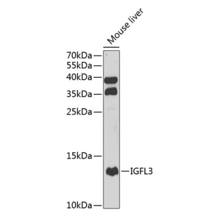 Western Blot - Anti-IGFL3 Antibody (A12086) - Antibodies.com