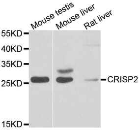 Western Blot - Anti-CRISP2 Antibody (A7177) - Antibodies.com