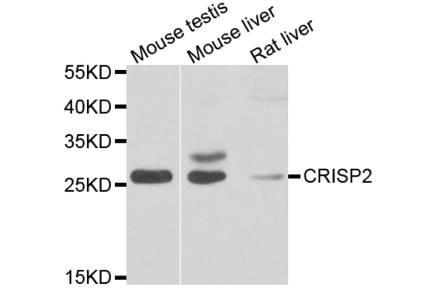 Western Blot - Anti-CRISP2 Antibody (A7177) - Antibodies.com