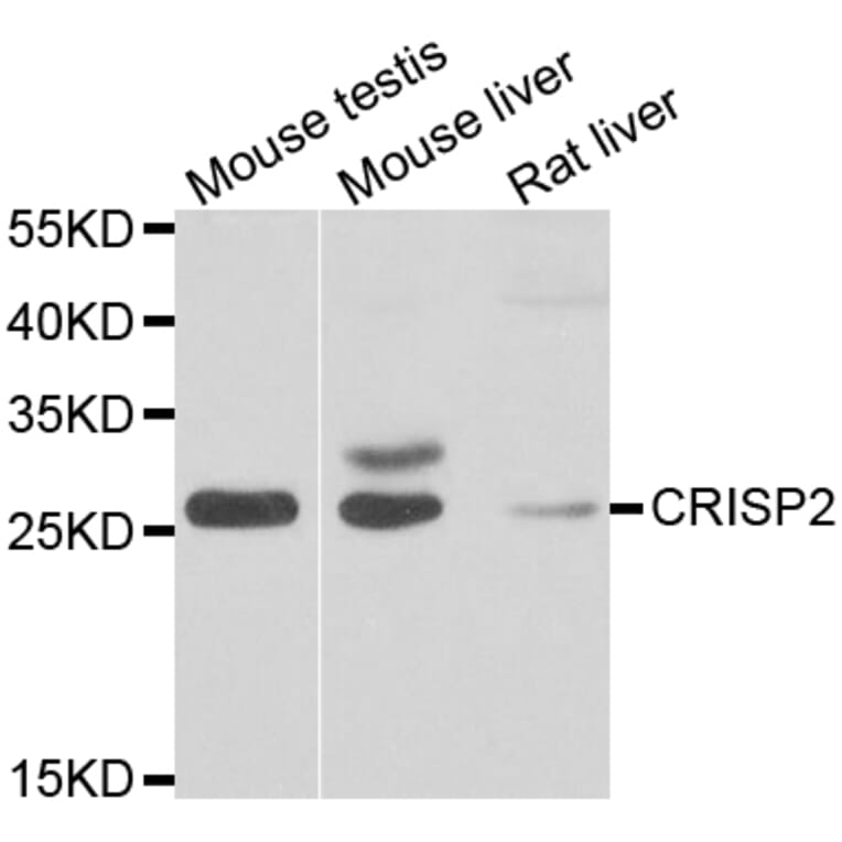 Western Blot - Anti-CRISP2 Antibody (A7177) - Antibodies.com