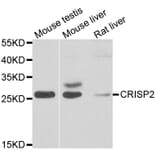 Western Blot - Anti-CRISP2 Antibody (A7177) - Antibodies.com