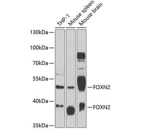 Western Blot - Anti-FOXN2 Antibody (A12088) - Antibodies.com