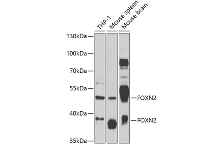 Western Blot - Anti-FOXN2 Antibody (A12088) - Antibodies.com