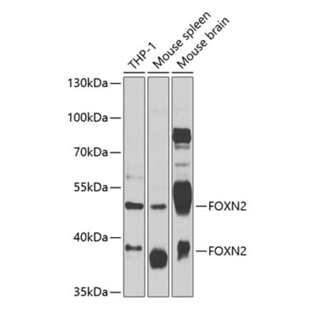 Western Blot - Anti-FOXN2 Antibody (A12088) - Antibodies.com