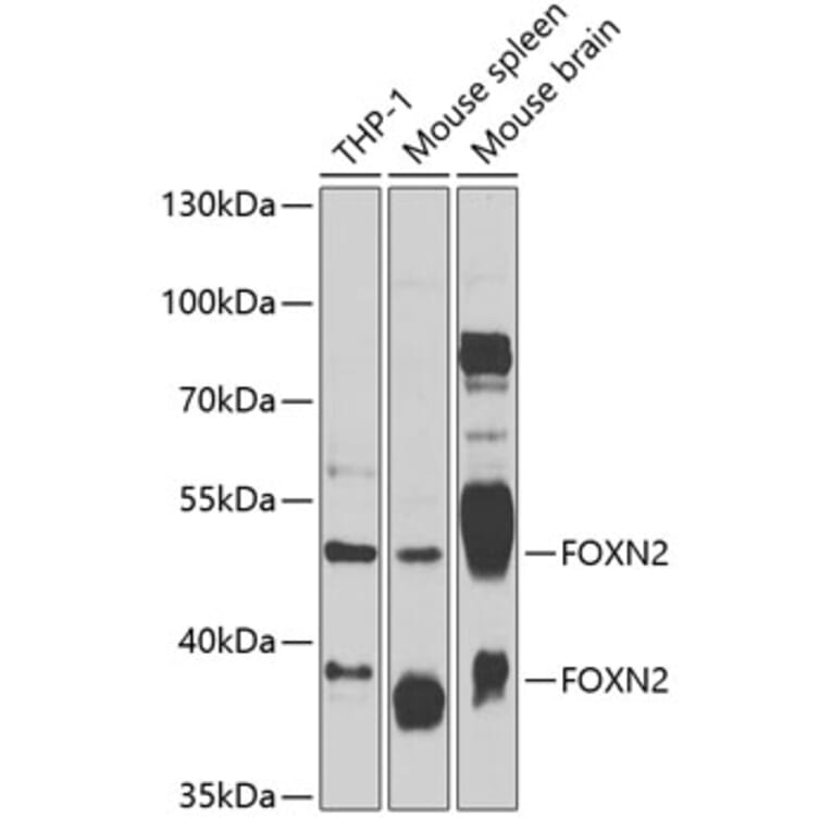 Western Blot - Anti-FOXN2 Antibody (A12088) - Antibodies.com