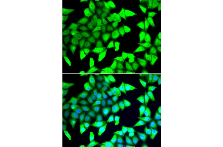Immunofluorescence - Anti-HDAC5 Antibody (A12089) - Antibodies.com