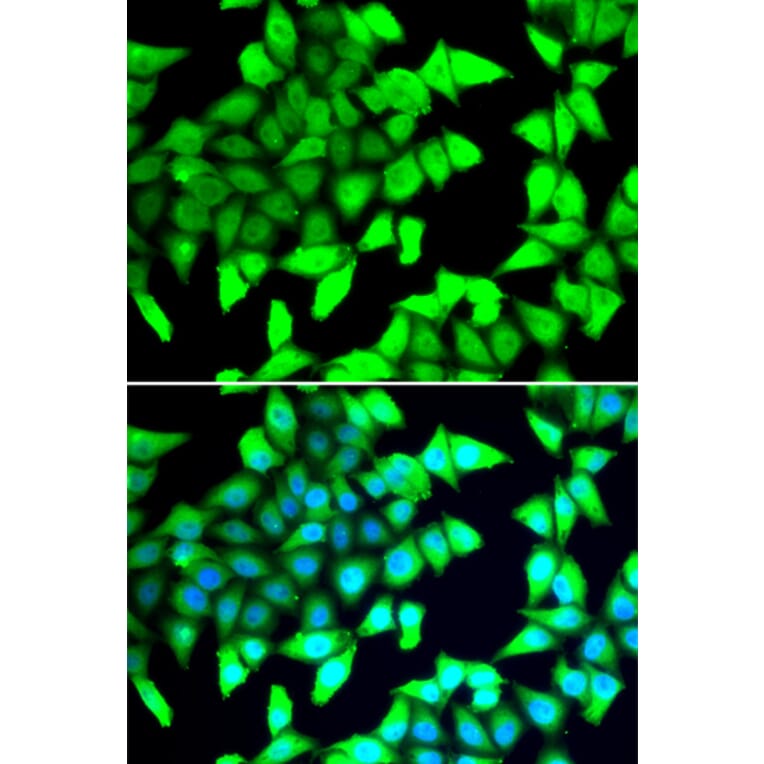 Immunofluorescence - Anti-HDAC5 Antibody (A12089) - Antibodies.com