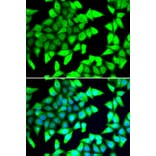 Immunofluorescence - Anti-HDAC5 Antibody (A12089) - Antibodies.com