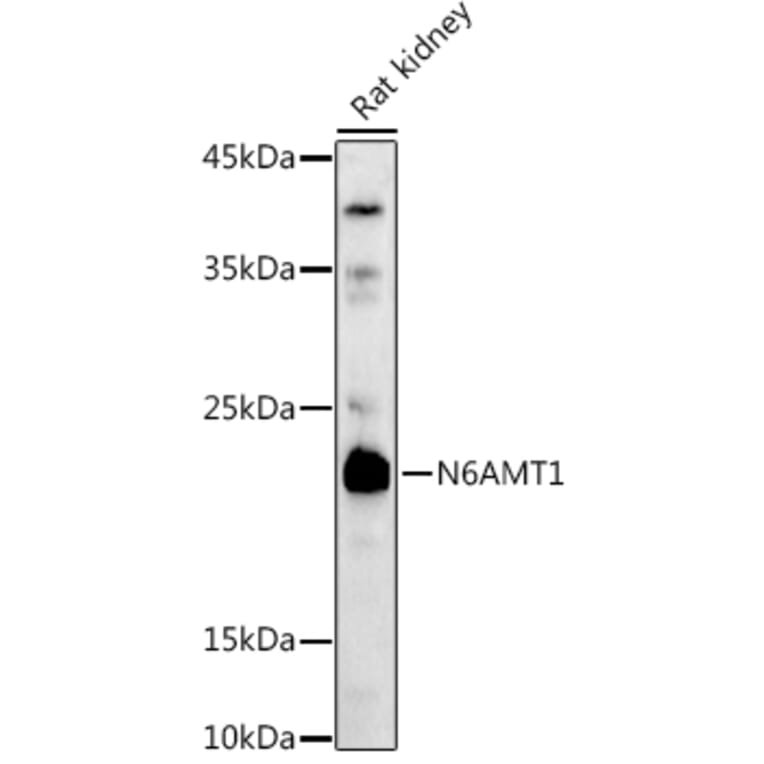 Western Blot - Anti-HEMK2/N6AMT1 Antibody (A12090) - Antibodies.com