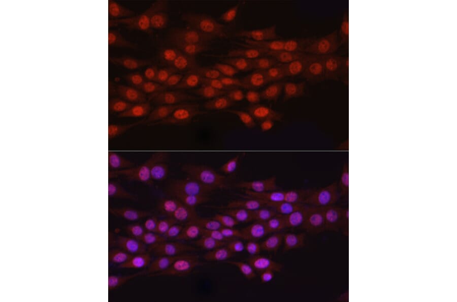 Immunofluorescence - Anti-HEMK2/N6AMT1 Antibody (A12090) - Antibodies.com