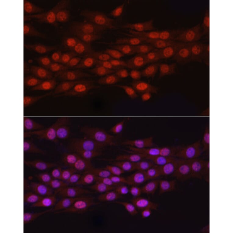 Immunofluorescence - Anti-HEMK2/N6AMT1 Antibody (A12090) - Antibodies.com