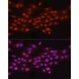 Immunofluorescence - Anti-HEMK2/N6AMT1 Antibody (A12090) - Antibodies.com