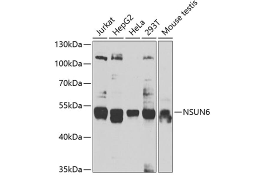 Western Blot - Anti-NSUN6 Antibody (A7205) - Antibodies.com