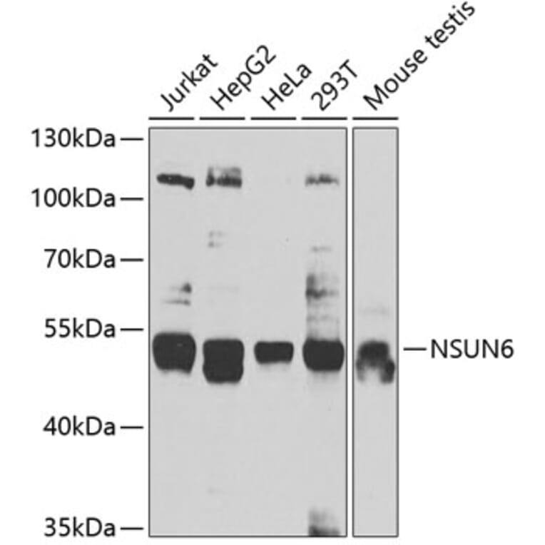 Western Blot - Anti-NSUN6 Antibody (A7205) - Antibodies.com