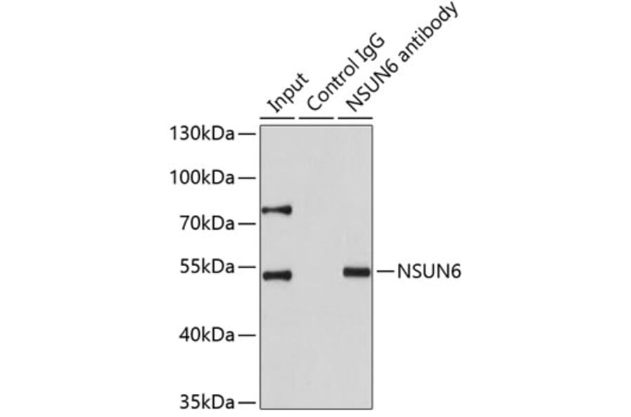 Immunoprecipitation - Anti-NSUN6 Antibody (A7205) - Antibodies.com
