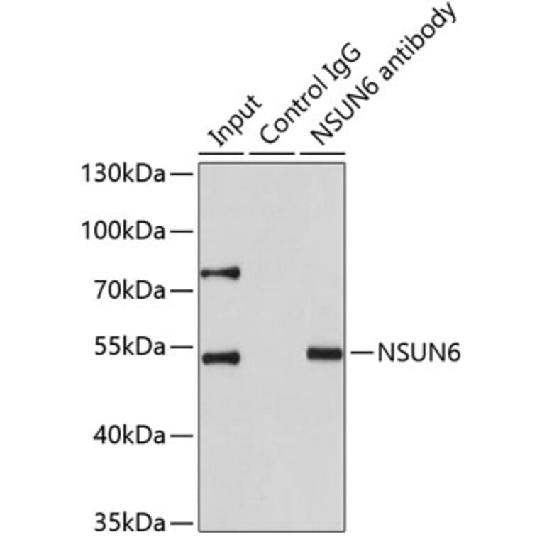Immunoprecipitation - Anti-NSUN6 Antibody (A7205) - Antibodies.com