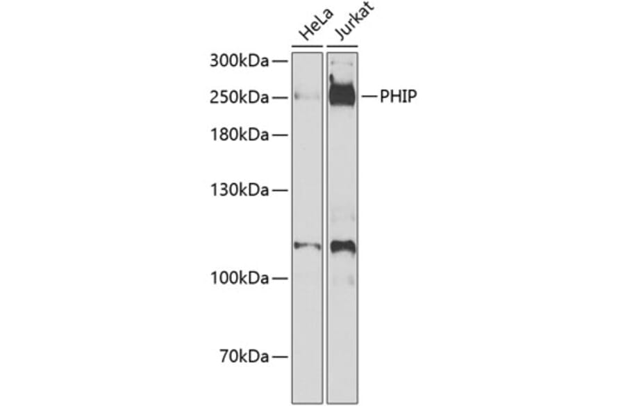 Western Blot - Anti-PHIP Antibody (A12092) - Antibodies.com