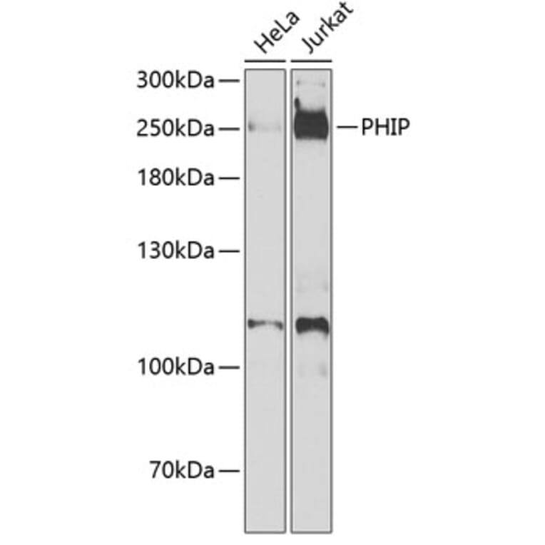 Western Blot - Anti-PHIP Antibody (A12092) - Antibodies.com
