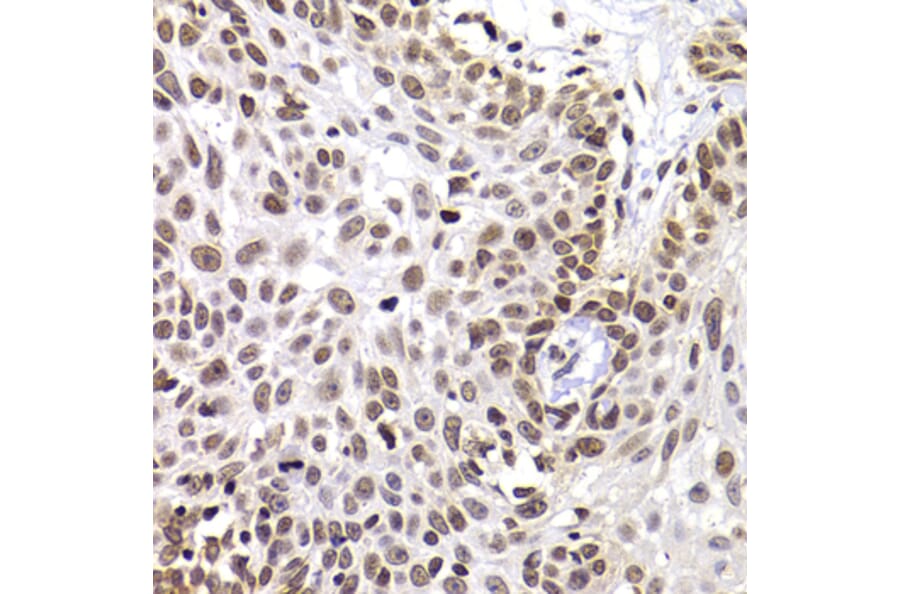 Immunohistochemistry - Anti-PHIP Antibody (A12092) - Antibodies.com