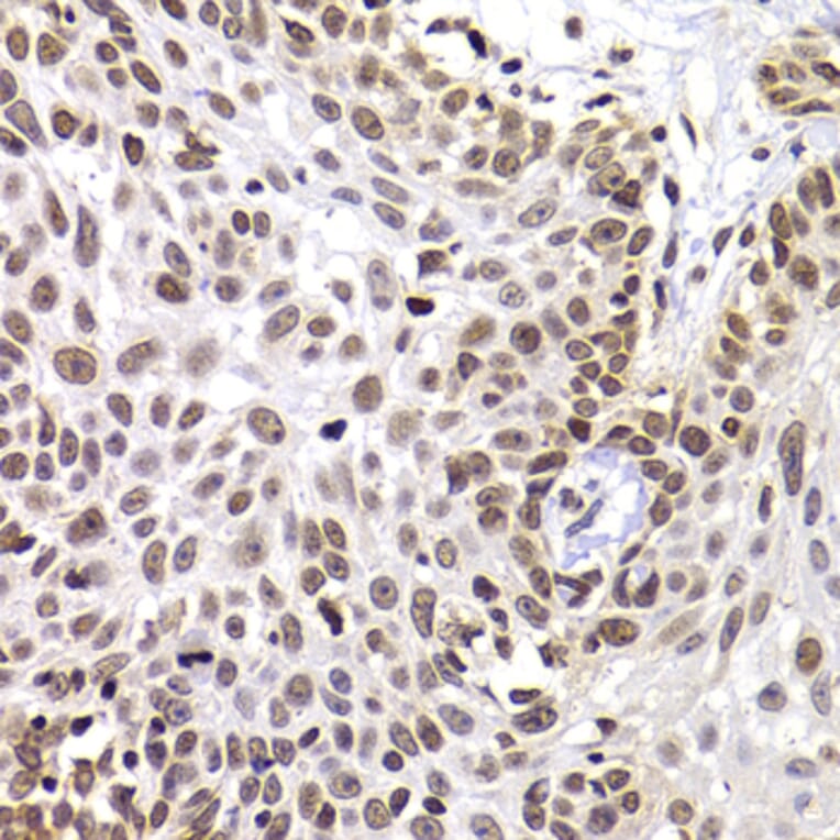 Immunohistochemistry - Anti-PHIP Antibody (A12092) - Antibodies.com