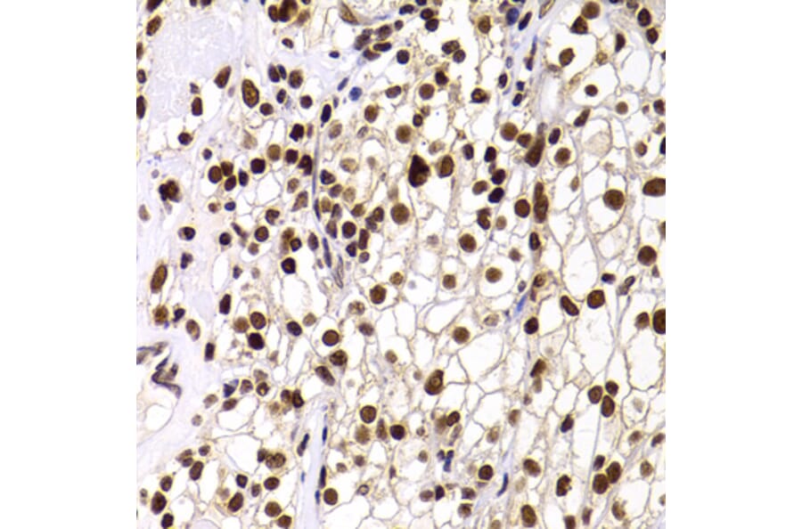 Immunohistochemistry - Anti-PHIP Antibody (A12092) - Antibodies.com