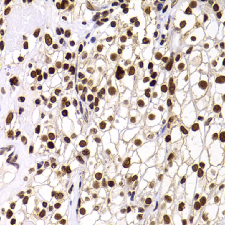 Immunohistochemistry - Anti-PHIP Antibody (A12092) - Antibodies.com