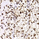 Immunohistochemistry - Anti-PHIP Antibody (A12092) - Antibodies.com