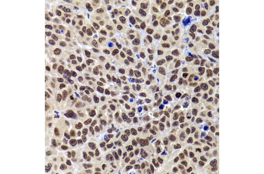 Immunohistochemistry - Anti-PHIP Antibody (A12092) - Antibodies.com