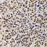 Immunohistochemistry - Anti-PHIP Antibody (A12092) - Antibodies.com