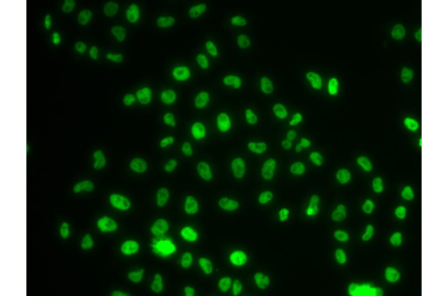 Immunofluorescence - Anti-PHIP Antibody (A12092) - Antibodies.com