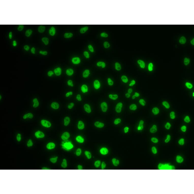 Immunofluorescence - Anti-PHIP Antibody (A12092) - Antibodies.com