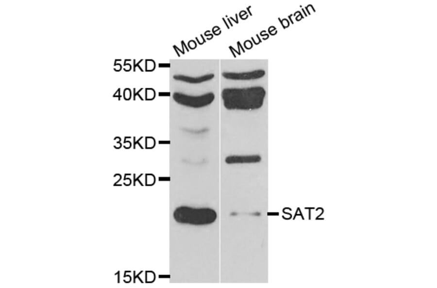 Western Blot - Anti-SAT2 Antibody (A7211) - Antibodies.com