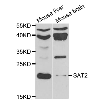 Western Blot - Anti-SAT2 Antibody (A12093) - Antibodies.com