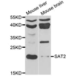 Western Blot - Anti-SAT2 Antibody (A7211) - Antibodies.com