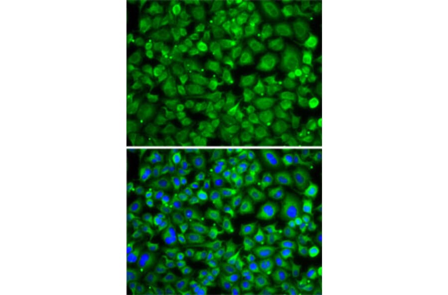 Immunofluorescence - Anti-SAT2 Antibody (A7211) - Antibodies.com