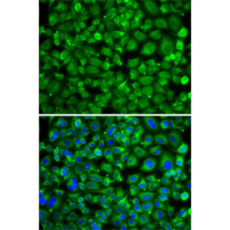 Immunofluorescence - Anti-SAT2 Antibody (A7211) - Antibodies.com